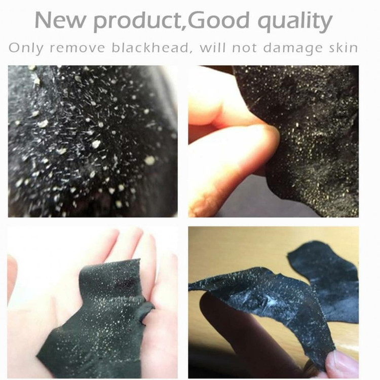 پک 200 عددی چسب بینی لانبنا ورقه ای پاک کننده قوی جوش سرسیاه